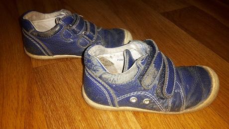 Topánky protetika, protetika,25