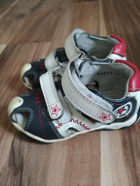 Sandálky protetika, protetika,21