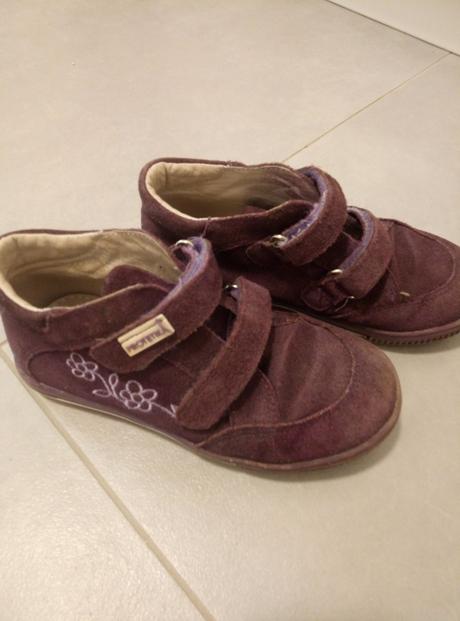 Topánky kožené, protetika,29