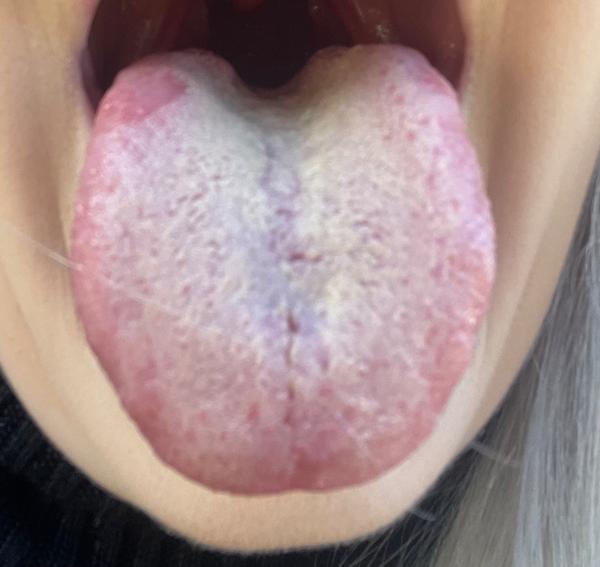 Z čoho môže byť takýto jazyk?