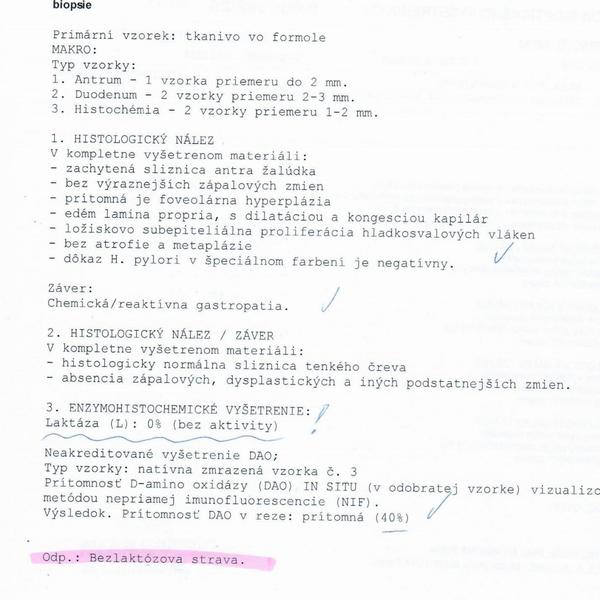 Čomu sa mám vyhýbať?