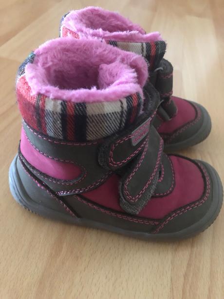 Zimne topanky, protetika,22