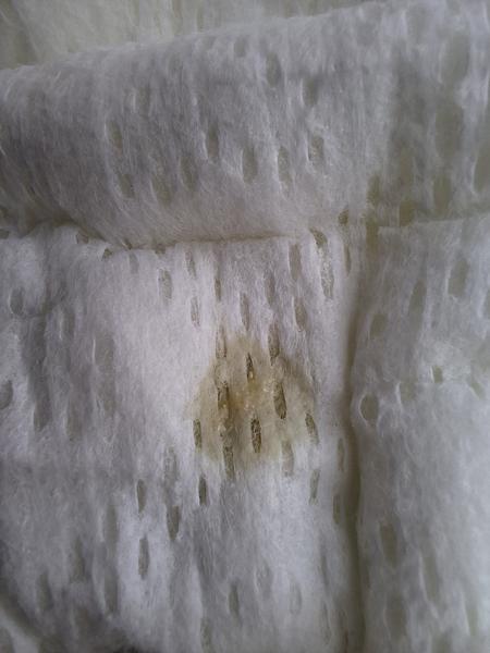 Žltý fľak v plienke u dojčaťa