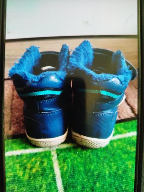 Topánočky protetika, protetika,23