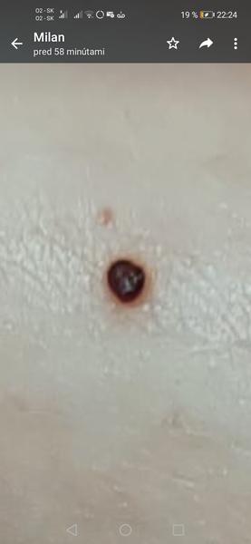 Čo spôsobuje svrbenie na koži?