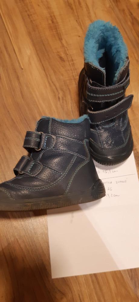 Protetika barefoot zimne, protetika,26