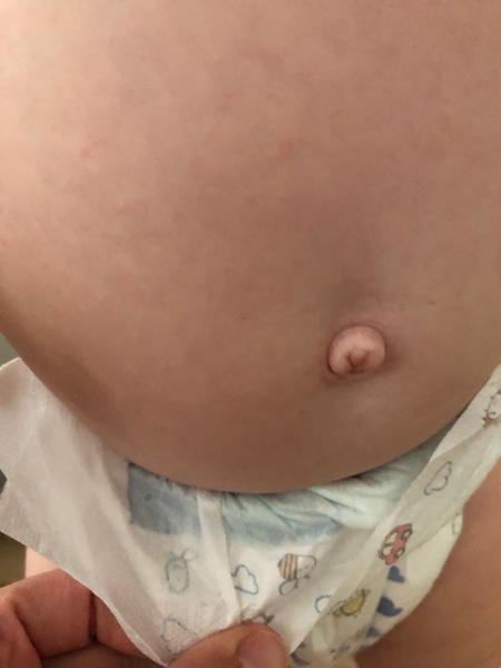 Má môj 13-mesačný synček pruh?