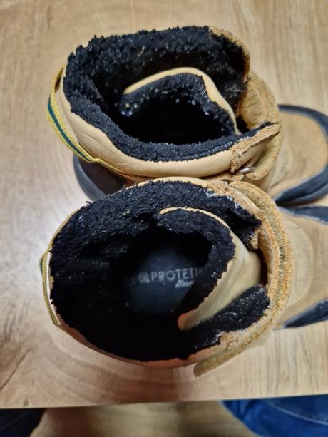 Barefoot protetika, protetika,28