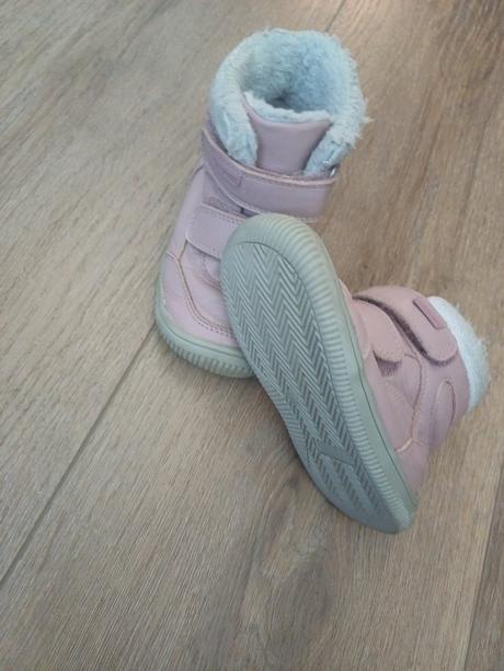 Topanky, protetika,24