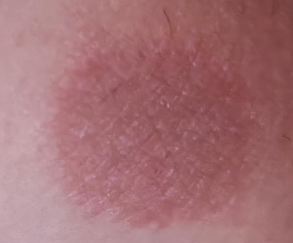 Môže to byť nejaký ekzém?