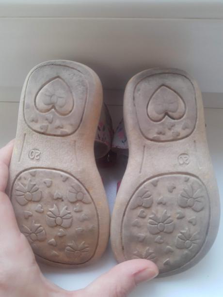 Protetika sandálky dievča 20, protetika,20