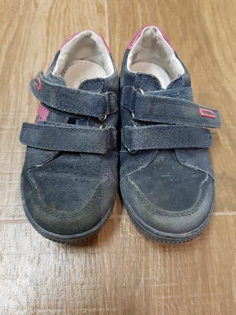 Topanky protetika, protetika,28