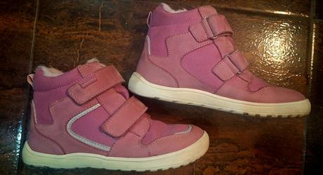 Protetika daxi pink, protetika,33