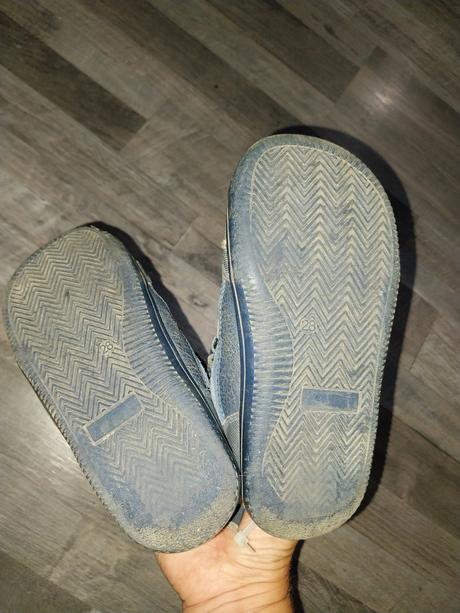 Topanky protetika, protetika,28