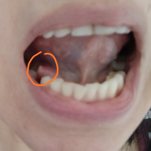 Výrastok pod jazykom