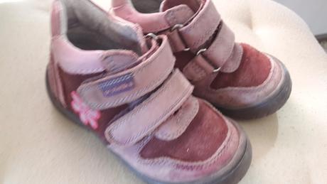 Malo nosene topanky, protetika,24