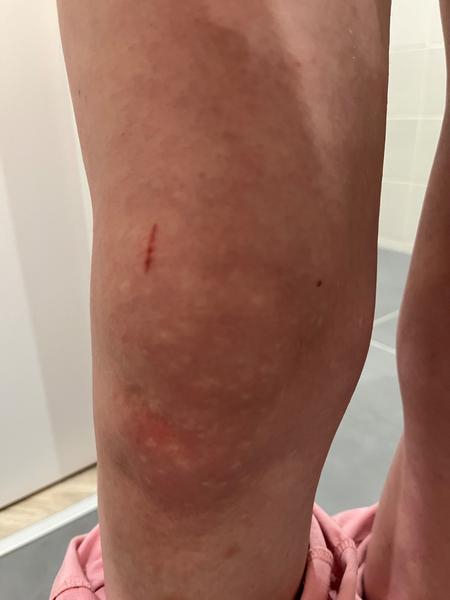 Nevysvetliteľné bolesti nôh