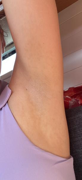 Máte škvrny v podpazuší? Skúsenosti a rady