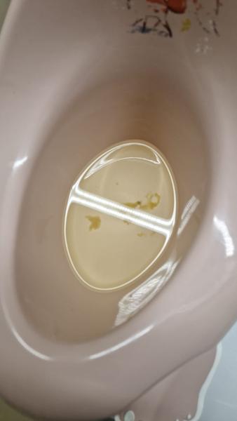 Čo to pláva v moči?