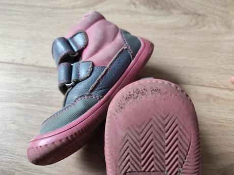 Protetika tyrel, protetika,25