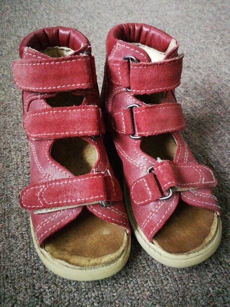 Protetika ortopedické sandále, protetika,26