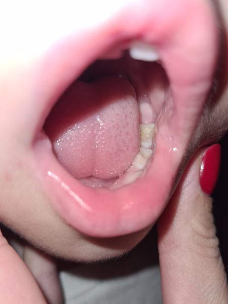 Má 2,5-ročné dieťa zuby šestky? Skúsenosti rodičov