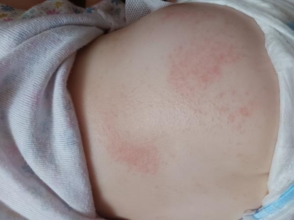 Sú to potničky alebo niečo iné?