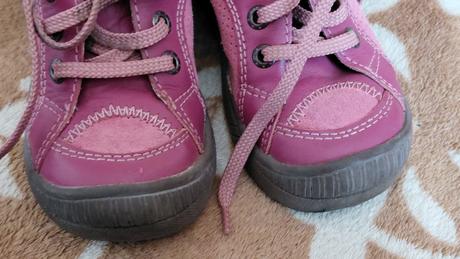 Protetika botičky, protetika,25