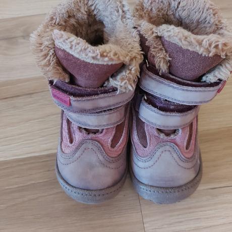 Čižmičky na zimu, protetika,24