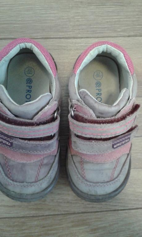 Prechodné topánky protetika, protetika,22