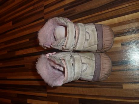 teple zimne topanky pre dievcatko, protetika,24