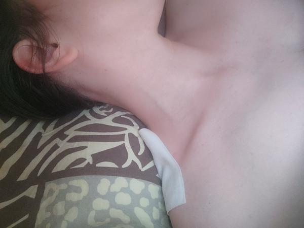 Už dva dni ma bolí krk