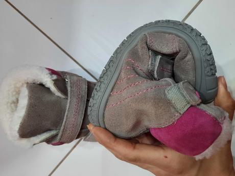 Zimné čižmy protetika, protetika,32