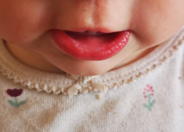 Objavil sa na perách soor u dieťaťa?