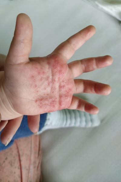 Je možné testovanie dvojročného dieťaťa?