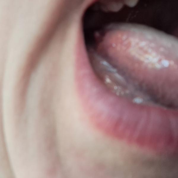 Zväčšené chuťové poháriky