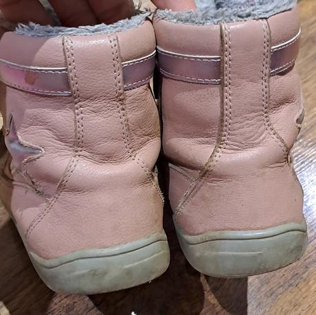 Zimne topanky, protetika,31