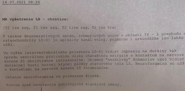 Výsledky MR chrbtice