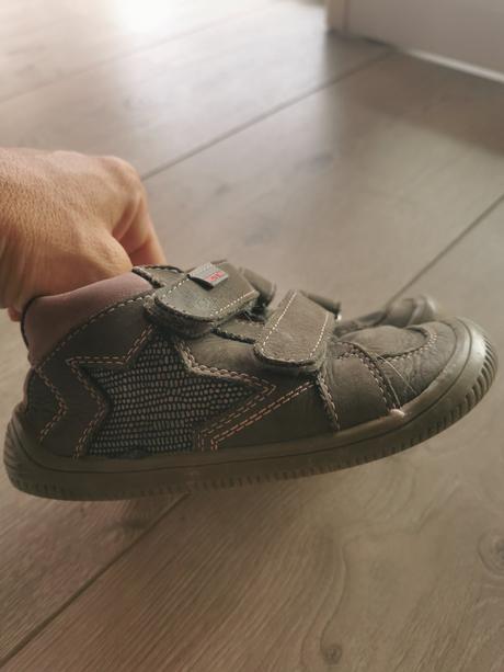 Ptotetika barefoot topanky, protetika,26