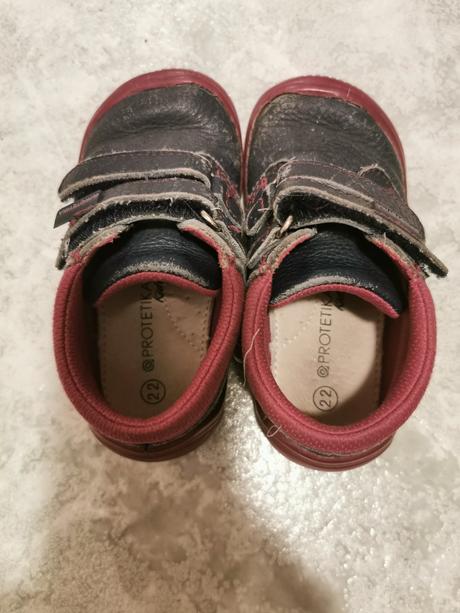 Protetika bf topanocky, protetika,22