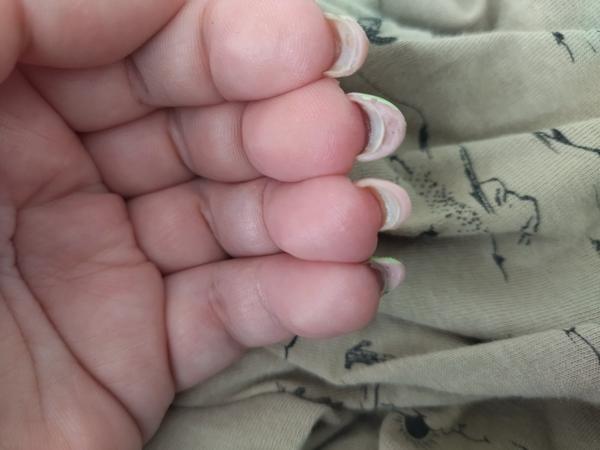 Kedy odstrániť nevydarené nechtové úpravy?