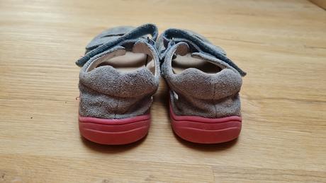 Sandálky, protetika,31