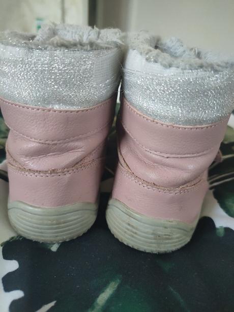 Čižmičky, protetika,25