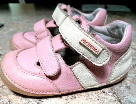 Protetika sandalky, protetika,23