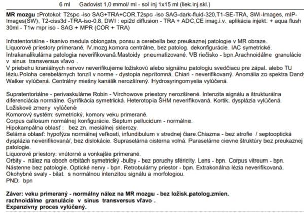 Aké sú moje výsledky z MRI vyšetrenia?
