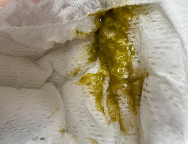 Stolica u trojmesačného