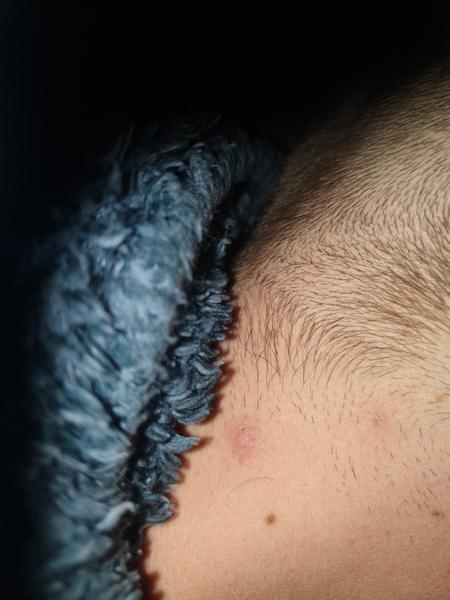 Čo mi pomôže na vredy?