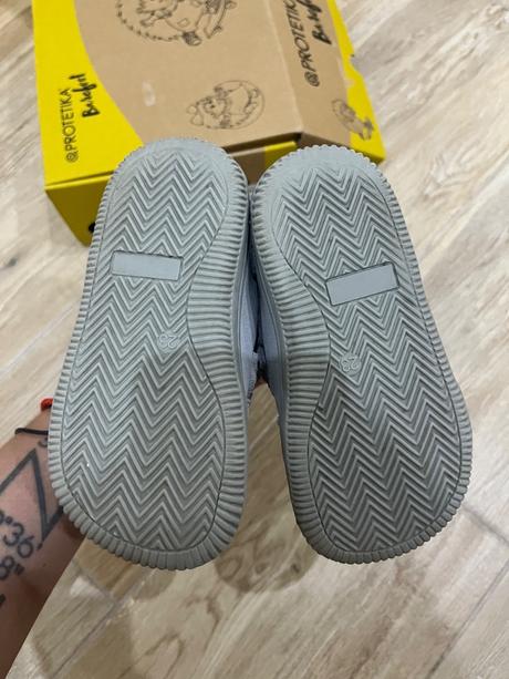 Protetika darta 23, protetika,23