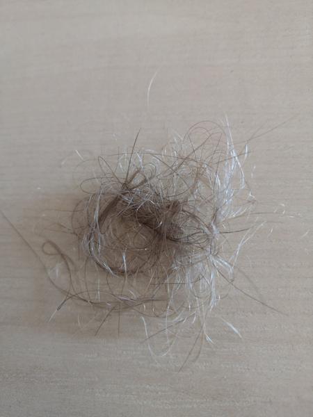 Je toto množstvo vypadnutých vlasov normálne?