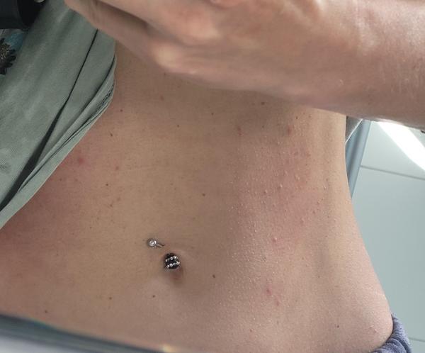 Je to alergia alebo niečo iné?